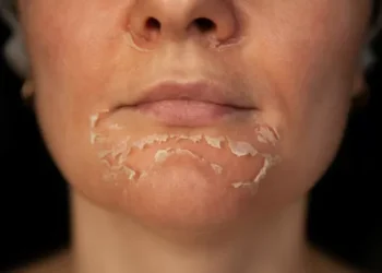 CFM solicita que Anvisa permita uso de fenol em procedimentos feitos por médicos