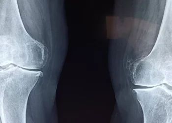 Exames de radiologia custaram 131 milhões em 2024