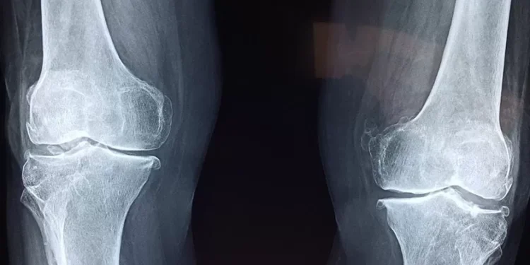 Exames de radiologia custaram 131 milhões em 2024