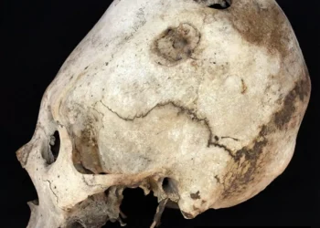 Povos antigos do Peru modificavam crânio para imitar montanhas!