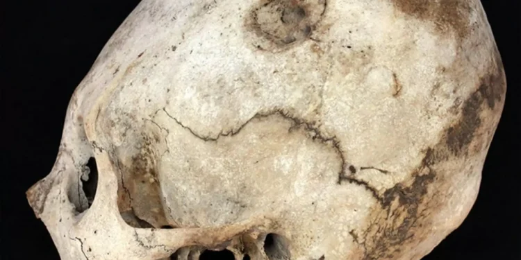 Povos antigos do Peru modificavam crânio para imitar montanhas!