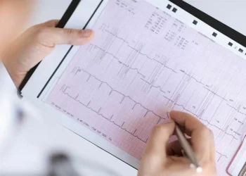 Mortes por enfarte agudo do miocárdio continuam a ser “das mais preocupantes”