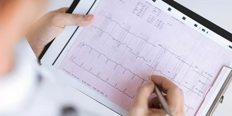 Mortes por enfarte agudo do miocárdio continuam a ser “das mais preocupantes”