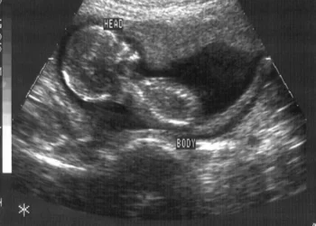 Cientistas avançam no tratamento da infertilidade criando óvulos artificiais