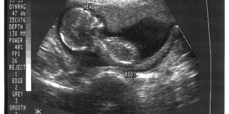 Cientistas avançam no tratamento da infertilidade criando óvulos artificiais